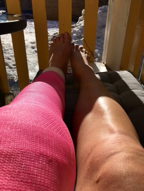 Bild på mina ben, ett med ett rosa gips, det andra barbent
